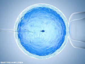 专家